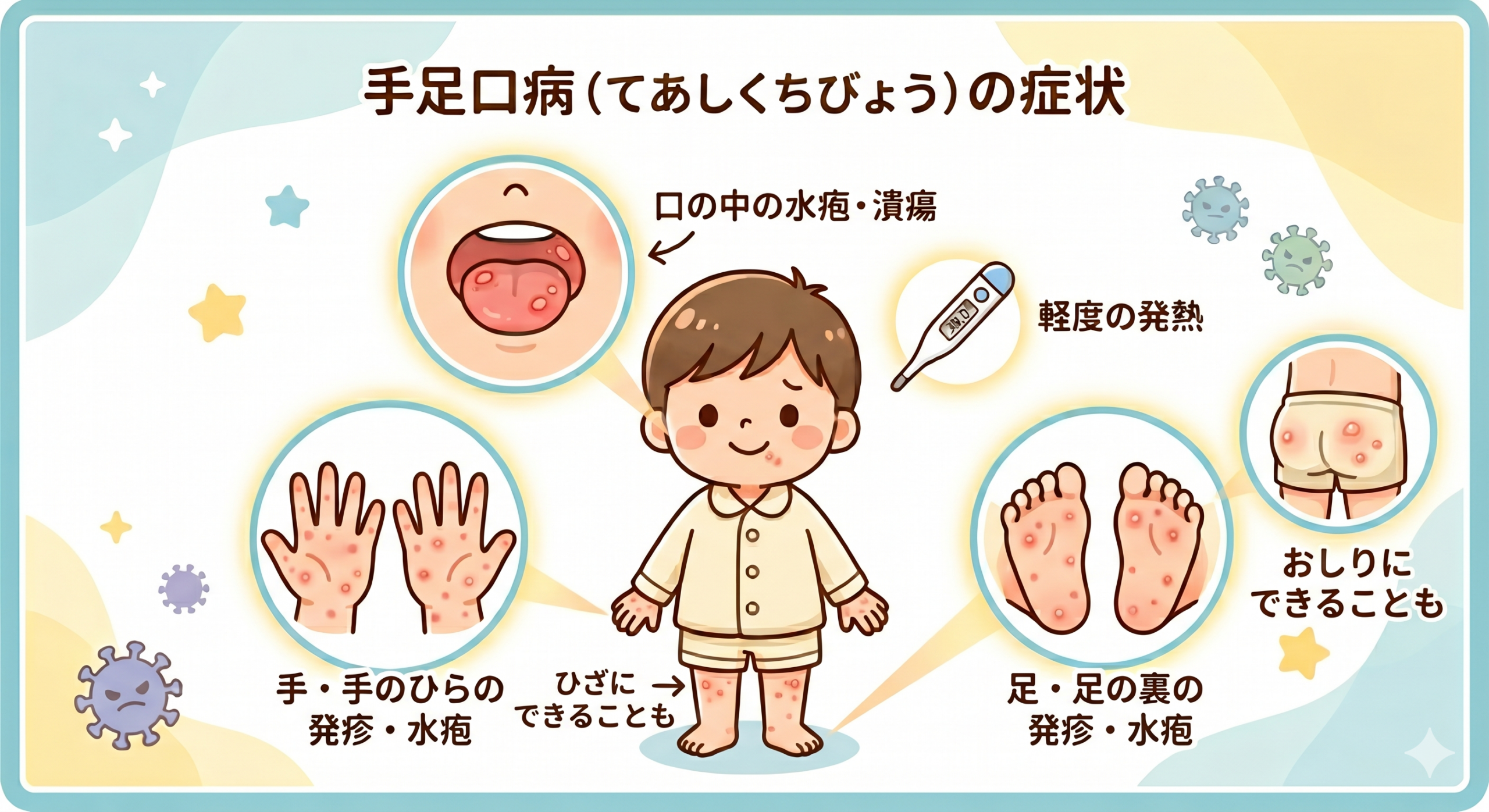 こどもの手足口病